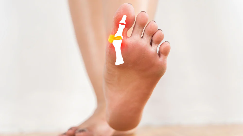 Minimally Invasive Foot & Ankle Surgery